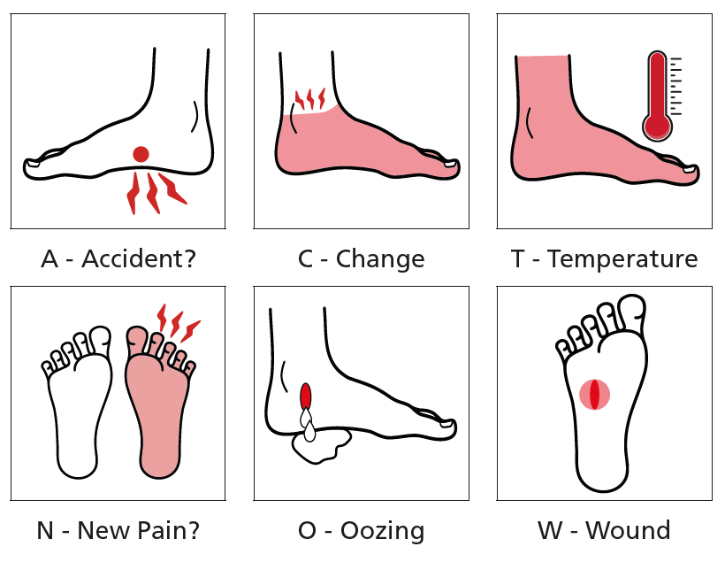 Images of feet and a range of dangerous signs and symptoms for those who are diabeticsigns.png